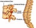 http://www.coloradospineinstitute.com/graphic/bvlicense/10_dp_latcutaway.jpg