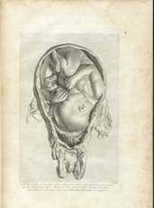 http://www.nlm.nih.gov/exhibition/historicalanatomies/Images/1200_pixels/Hunterw_table_12.jpg